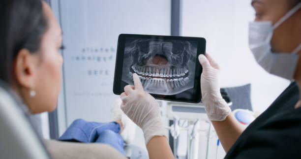 Licensed Dental Implants service in Flanders, NJ - Smile Center Dentistry